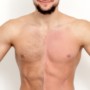 Depilación Masculina con Cera Tradicional