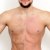 Abdomen